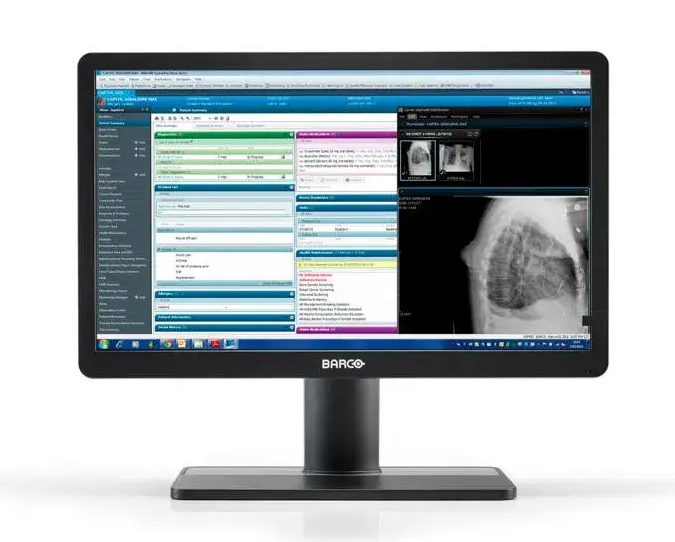 医用ディスプレイ Eonis 22 (MDRC-2422 SNIB) 21.5型/1920×1080/DVI、DisplayPort、HDMI/ブラック/スピーカー：なし