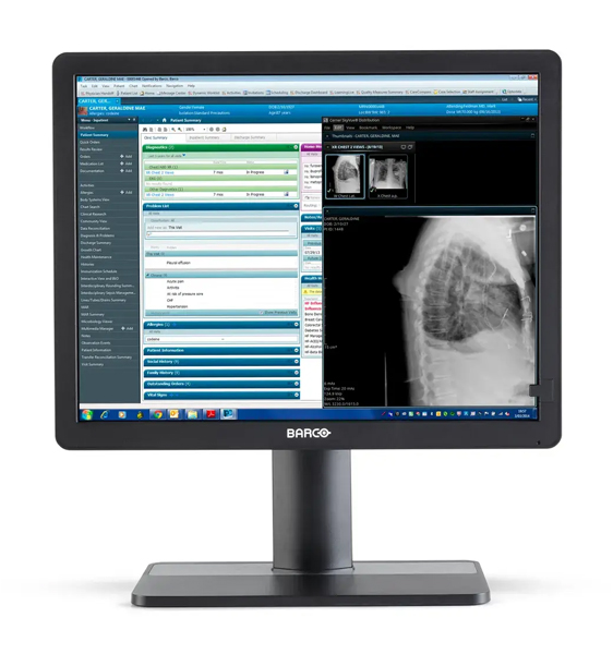 医用ディスプレイ Eonis 21 (MDRC-2421 SNIB) 21.3型/1600×1200/DVI、DisplayPort、HDMI/ブラック/スピーカー：なし