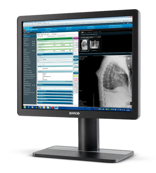 医用ディスプレイ Eonis 21 (MDRC-2421 SNIB) 21.3型/1600×1200/DVI、DisplayPort、HDMI/ブラック/スピーカー:なし