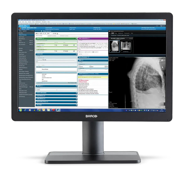 医用ディスプレイ Eonis 24 (MDRC-2424 SNIB) 24.0型/1920×1200/DVI、DisplayPort、HDMI/ブラック/スピーカー：なし