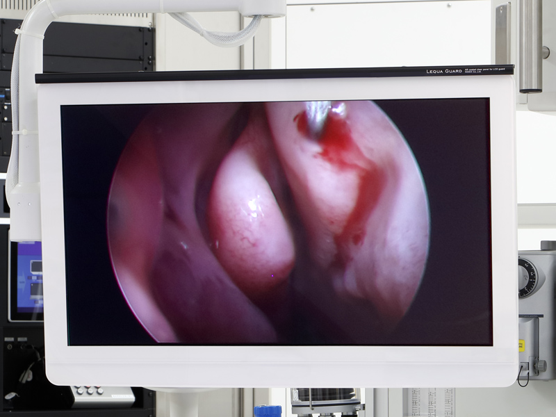 病院用反射防止膜付き液晶モニター保護パネル レクアガード カスタム2 M(30～40型以下)